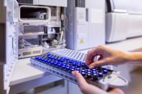 The laboratory scientist prepares samples for download to High-performance Liquid Chromatograph Mass Spectrometr.